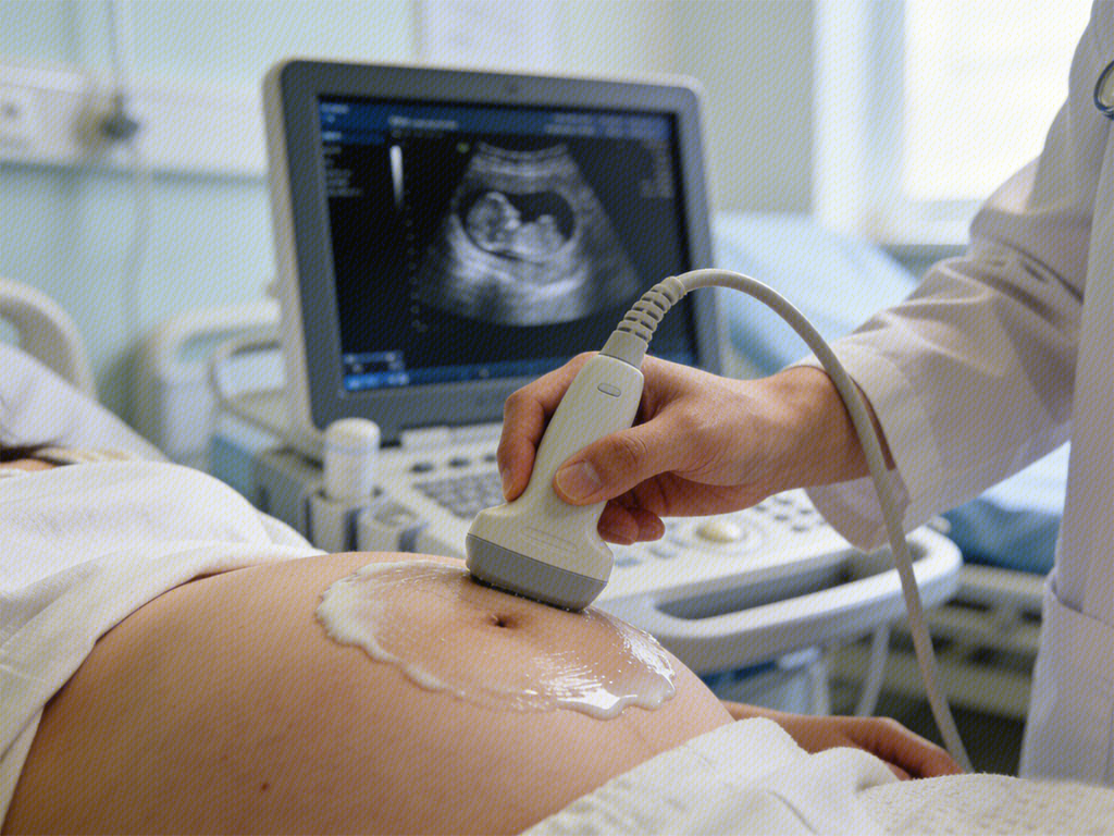 产检 孕期产检 超声检查 B超检查